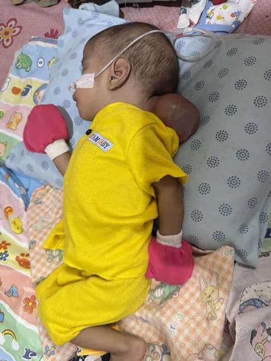 Foto campaign URGENT Benjolan di Kepala Bayi Uwais Kian Membesar Bantu Segera