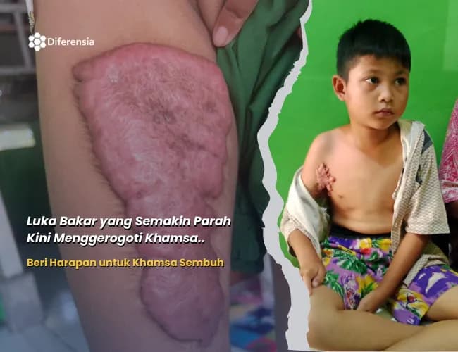 Foto campaign URGENT Semakin Membesar Bantu Khamsa Operasi Segera