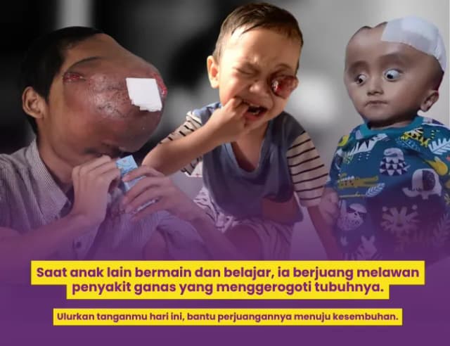 Selamatkan Anak Pejuang Sembuh dari Penyakit Ganas
