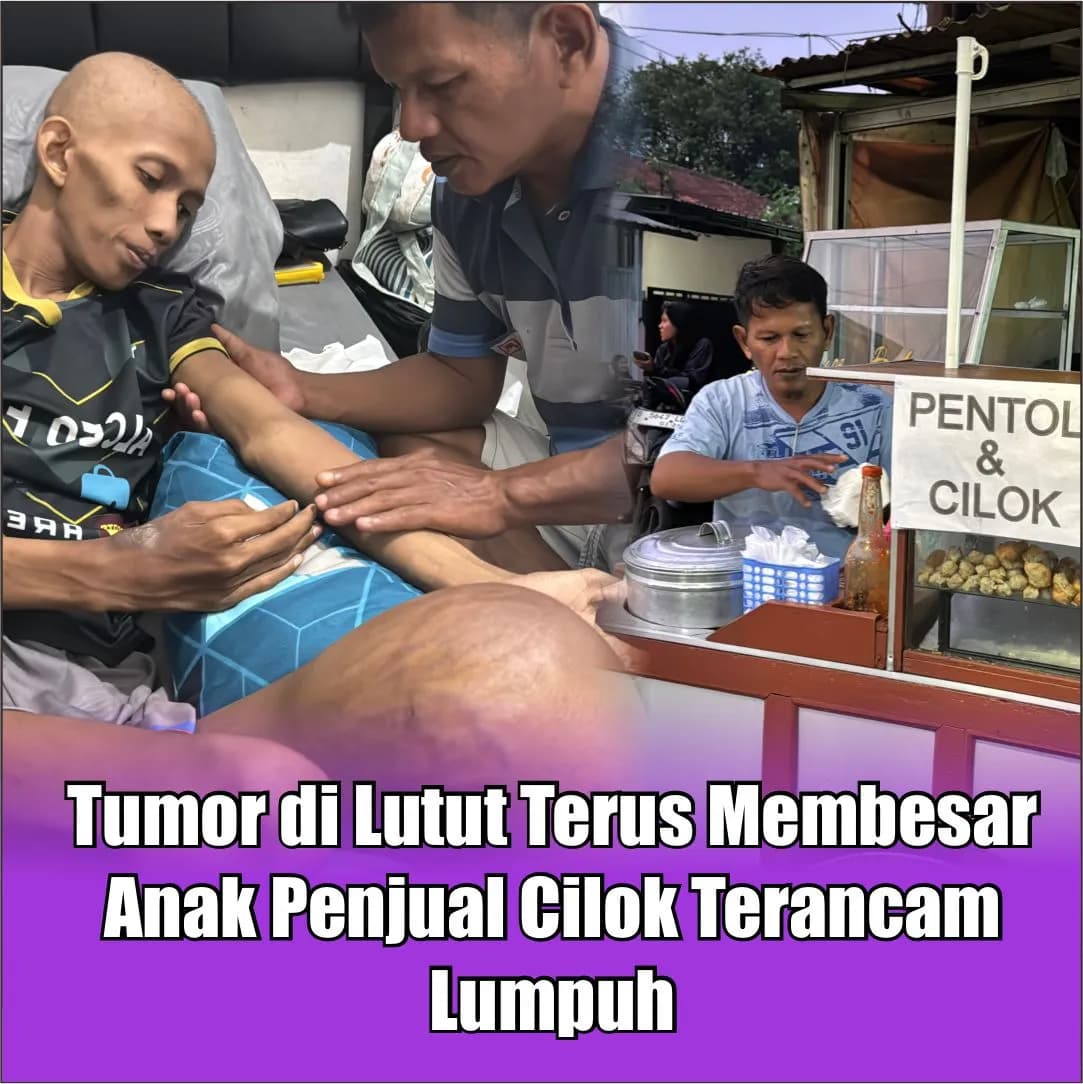Foto campaign Terancam Diamputasi Selamatkan Anak Penjual Cilok Keliling