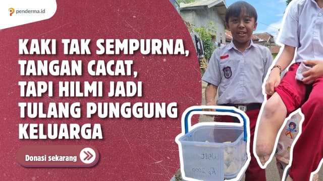 Kaki dan Tangan Tak Sempurna Hilmi Jadi Tulang Punggung Keluarga