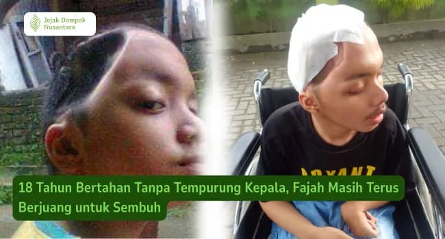 Foto campaign Bantu Fajah untuk Kembali Sembuh