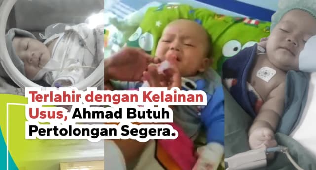 Terlahir Dengan Kelainan Usus Ahmad Butuh Pertolongan Segera