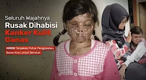 Foto campaign Tak Tahan SakitnyaTolong Bawa Ana Operasi ke RS