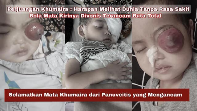 URGENT - Khumaira Terancam Buta