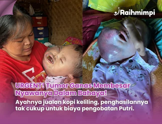 Foto campaign Urgent Bantu Putri Anak Penjual Kopi Keliling Operasi