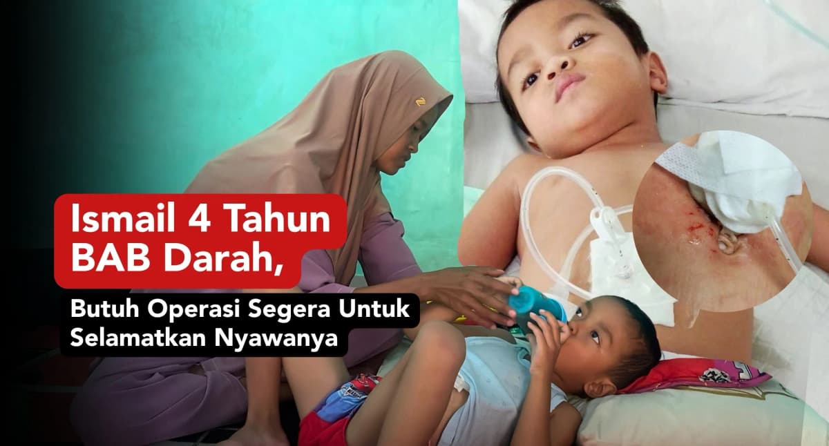 Foto campaign 4 Tahun BAB Darah Ismail Butuh Operasi Segera Agar Selamat