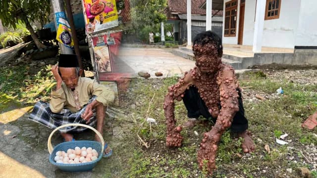 Bantu Lansia Pejuang Sembuh tuk Bertahan