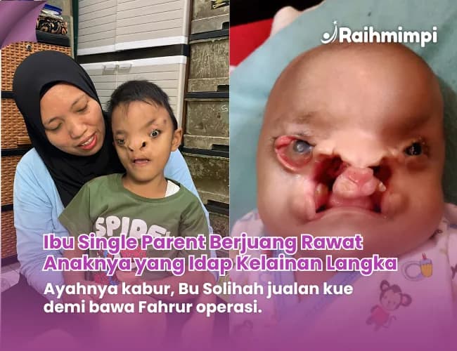 Foto campaign Sering Dibully Fahrur Butuh Kita untuk Melanjutkan Pengobatannya