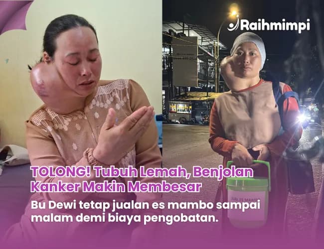 Foto campaign Tolong Tukang Es Mambo Dari Ganasnya Kanker Tiroid