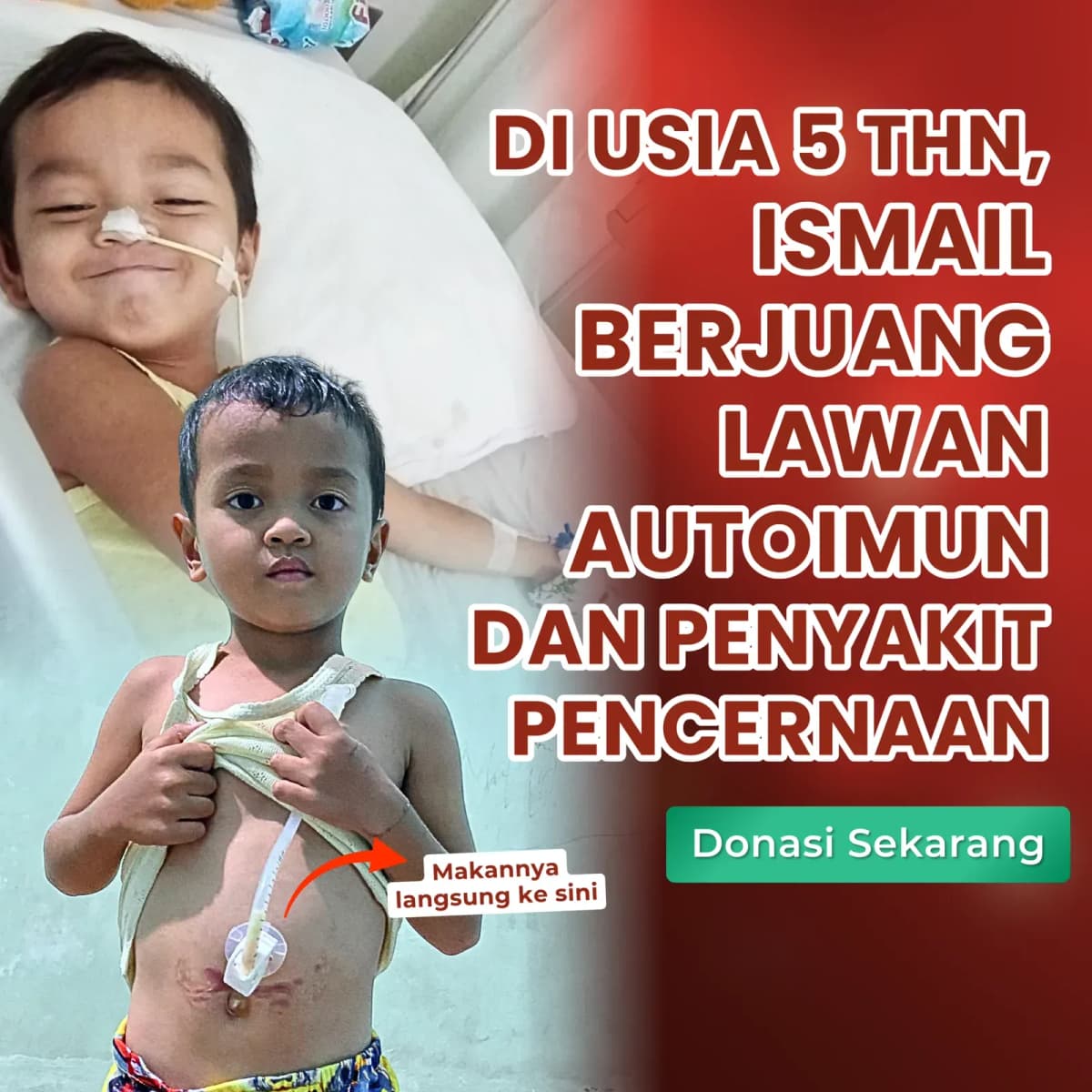 Foto campaign Jangan Biarkan Ismail Menyerah Karena Keterbatasan Biaya