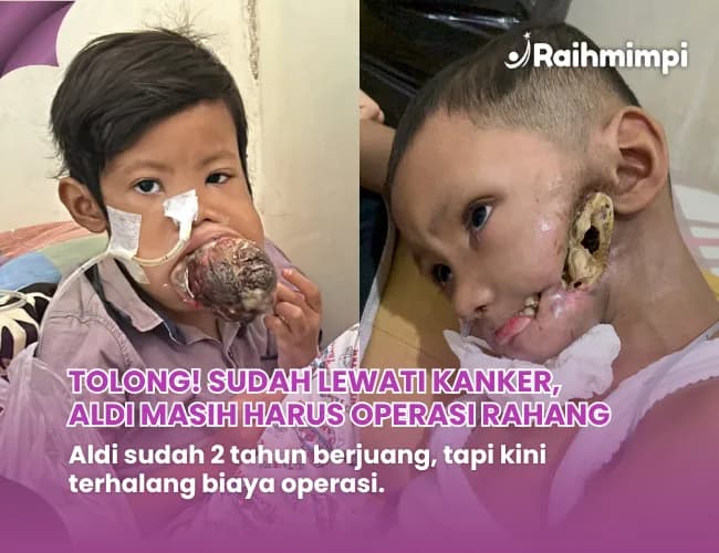 Foto campaign Sembuhkan Dik Aldi Dari Kanker Mulut
