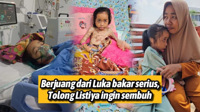 Tolong Listiya Sembuh dari Luka bakar serius