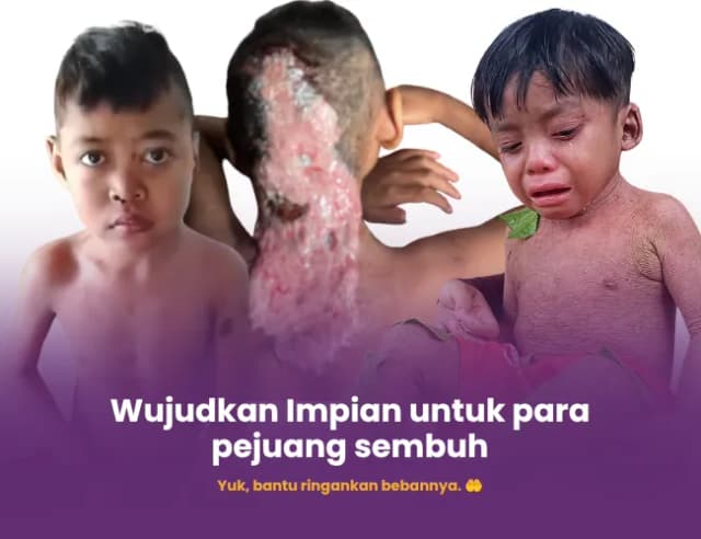 Wujudkan Impian para Pejuang Kesembuhan