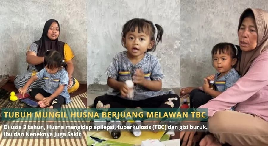 Foto campaign Tubuh Mungil Husna Berjuang Melawan TBC Ibu dan Neneknya Juga Sakit