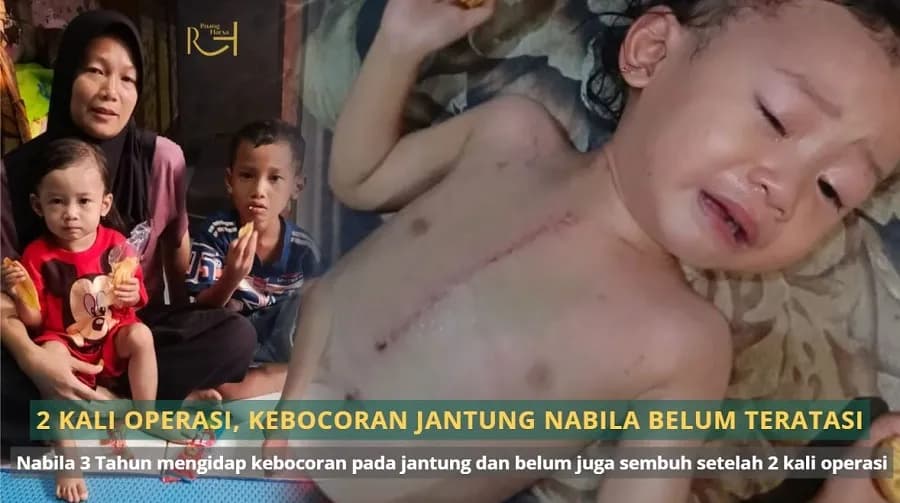 Foto campaign Sudah 2 Kali Operasi Jantung Nabila Masih Berjuang untuk Sembuh