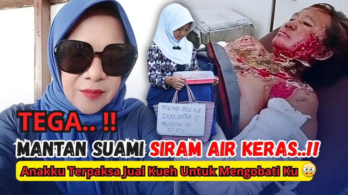 Foto campaign Bantu Pengobatan Bu Sani Yang Di Siram Air Keras Oleh Mantan Suaminya