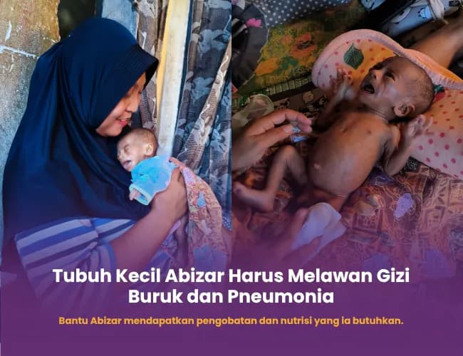 Foto campaign Bantu Abizar Lawan Gizi Buruk dan Pneumonia