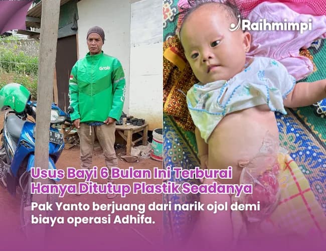 Foto campaign Urgent Bantu Dek Adifa Lanjutkan Operasi