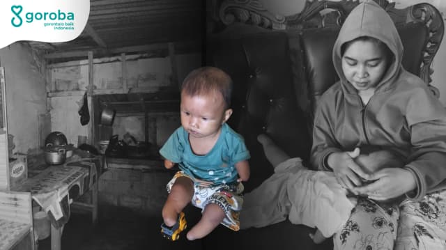 Mimpi Athar Ingin Punya Kaki Palsu