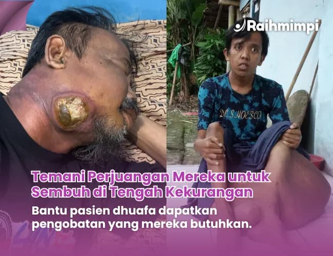 Foto campaign Tolong Mereka Berjuang Sembuh Di Tengah Kekurangan