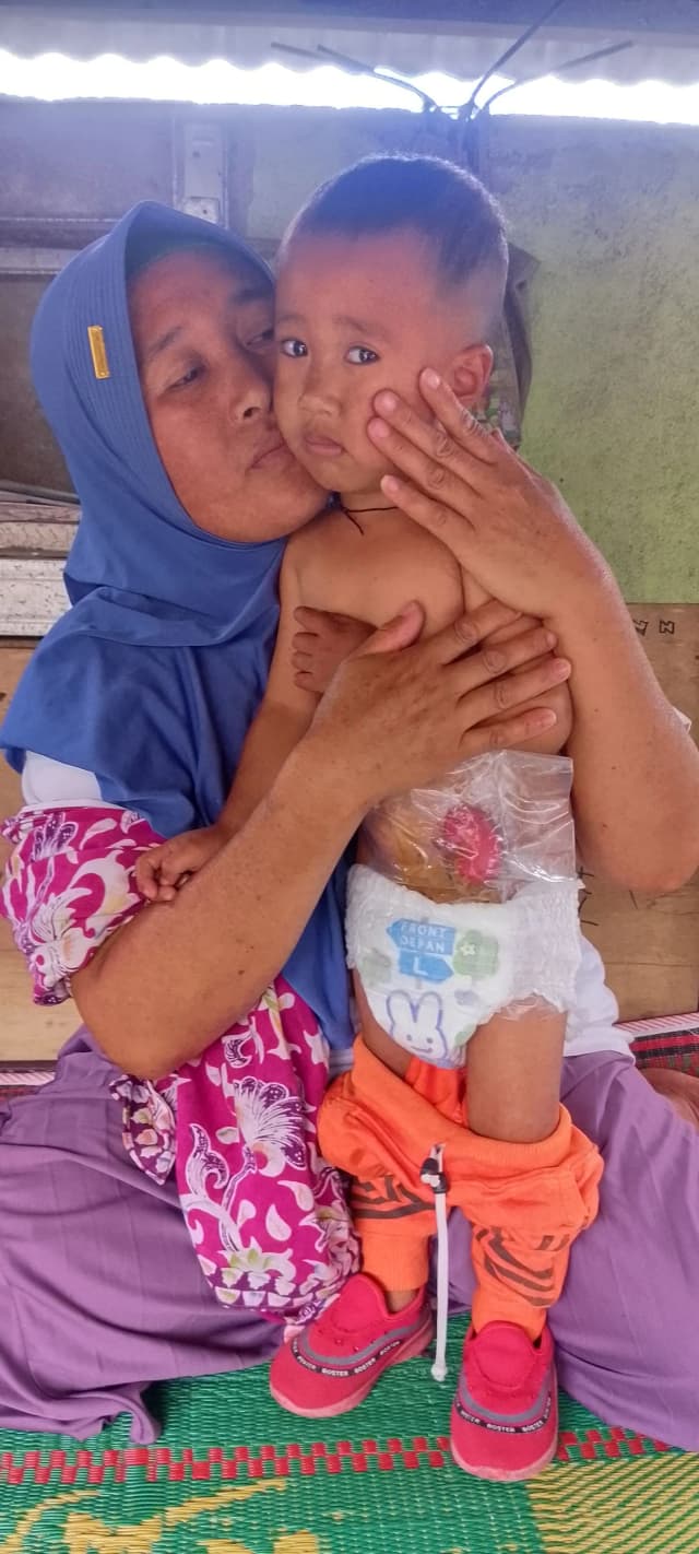 Usus Harus Dikeluarkan, Bantu Perjuangan Syakban untuk Sembuh