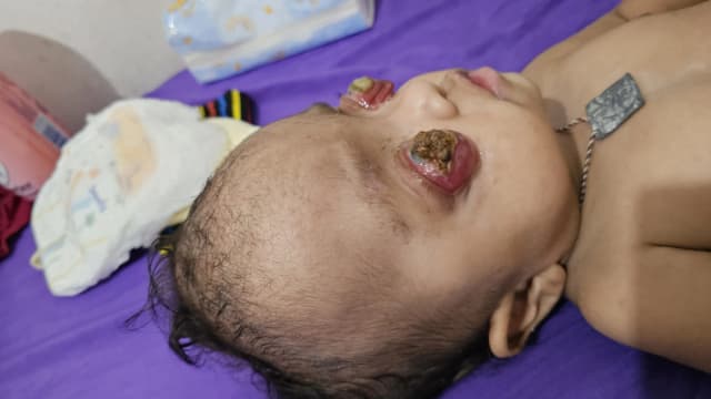 Bantu Amanda Melawan Kanker Mata di Usia 1 Tahun