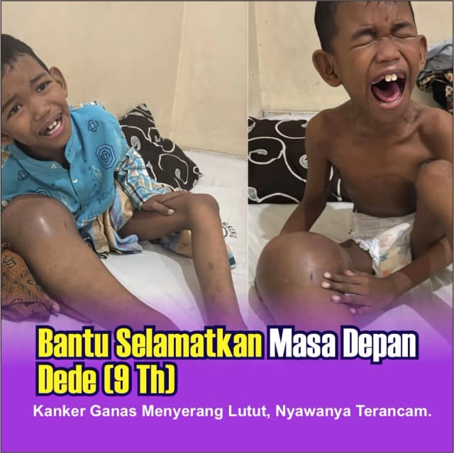 Tolong Tumor Tulang Mengancam Nyawa Dede 9 Th