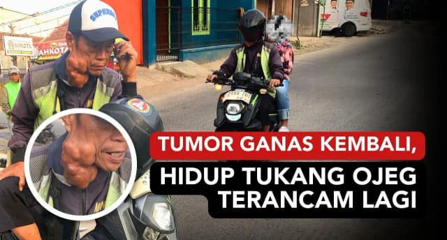 Bantu Lansia Tukang Ojek Dari Tumor Ganas