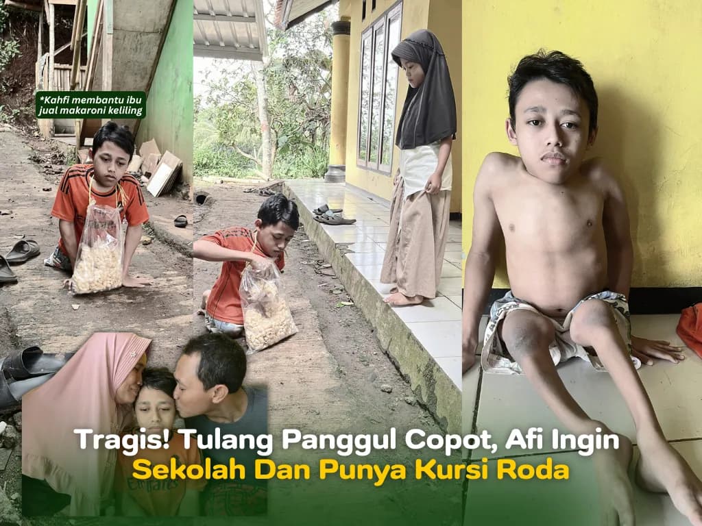 Foto campaign TRAGIS Tulang Panggul Copot Afi Ingin Sekolah dan Punya Kursi Roda