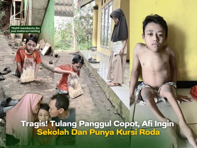 TRAGIS Tulang Panggul Copot Afi Ingin Sekolah dan Punya Kursi Roda