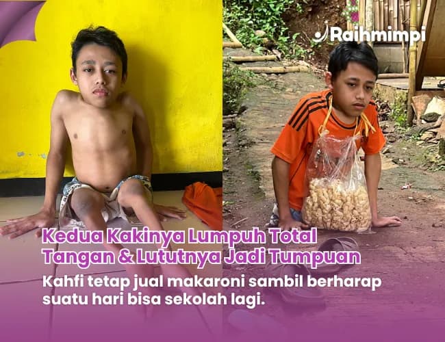 Foto campaign TRAGIS Tulang Panggul Copot Afi Ingin Sekolah dan Punya Kursi Roda