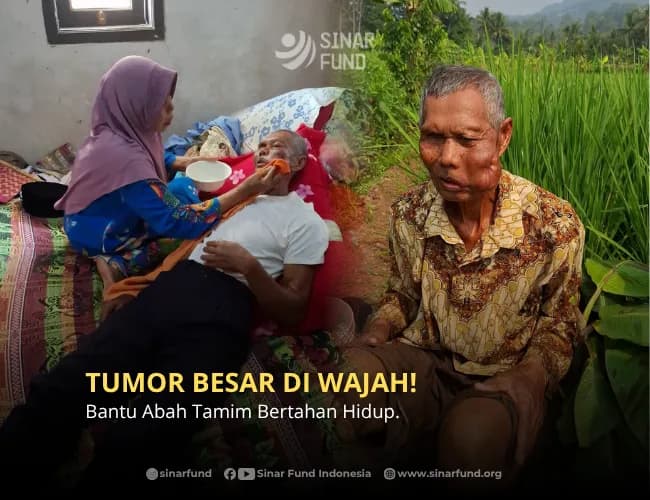 Foto campaign Tumor Membesar Abah Tamim Tetap Berjuang
