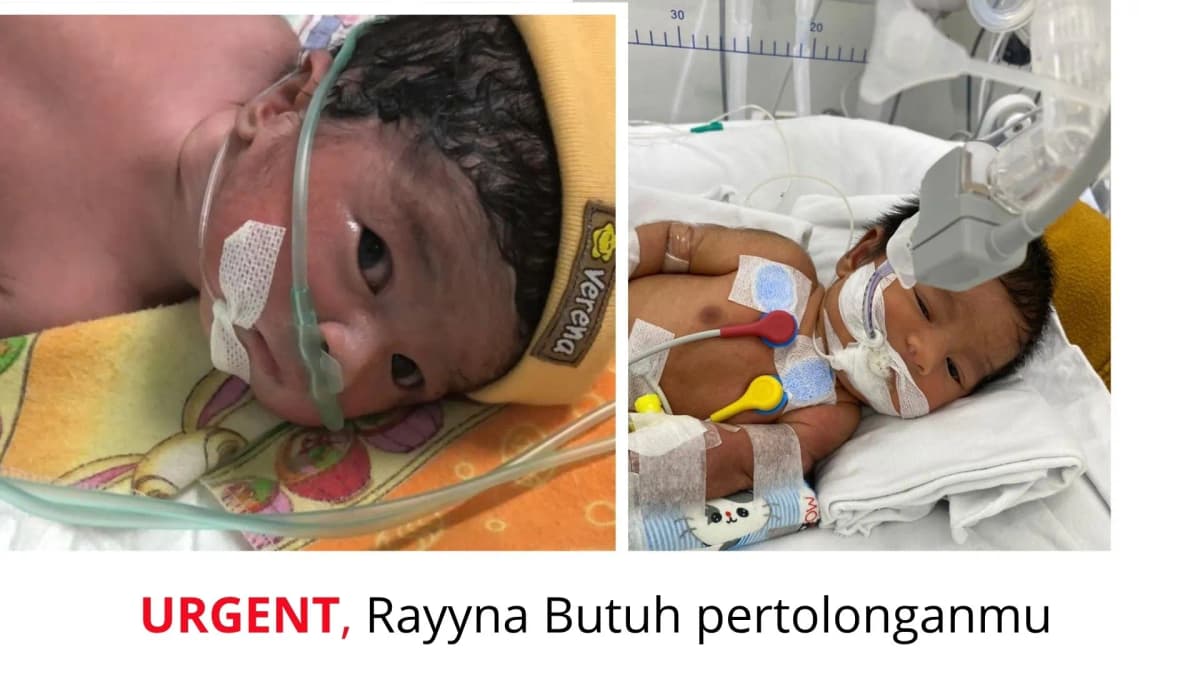 Foto campaign Bantu Anak Ojol Sembuh Dari Penyakit Hernia Diafragmatika