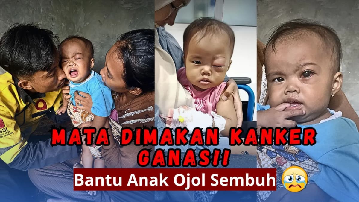 Foto campaign Bantu Pengobatan Cindara Lawan Kanker Mata Ganas