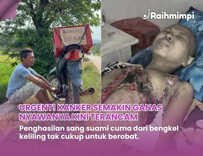 Foto campaign KANKER PAYUDARA GANAS MENGGEROGOTI DADA MBAK SITI, 6 KALI KEMOTERAPI HARUS IA JALANI