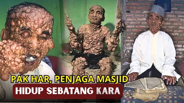 TUBUH DIPENUHI BENJOLAN, PAK HAR PENJAGA MASJID HIDUP SEBATANG KARA DAN SERBA KEKURANGAN