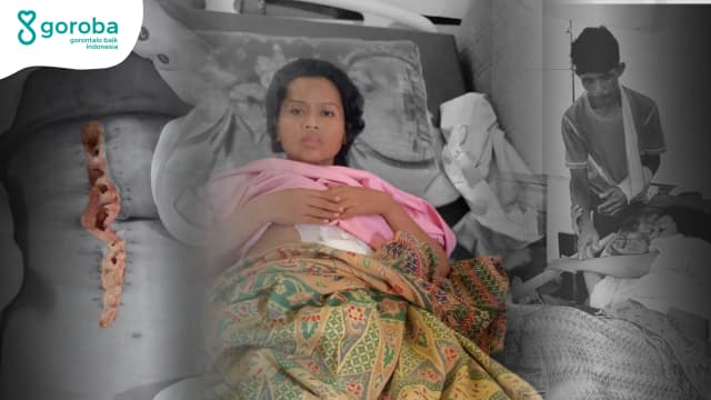 Bantu Bu Susmiati Melawan Kanker Serviks