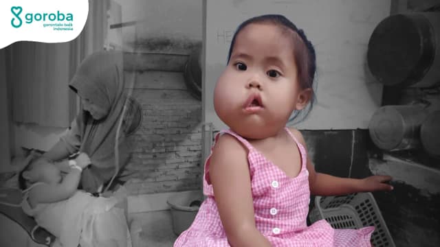 Tumor Membesar Azalia Nanti Mukjizat Operasi