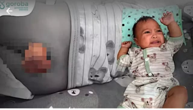 Bersama Bantu Pengobatan Bayi Ayla
