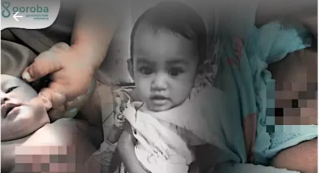 Bantu Tangan Kecil Amira Pulih