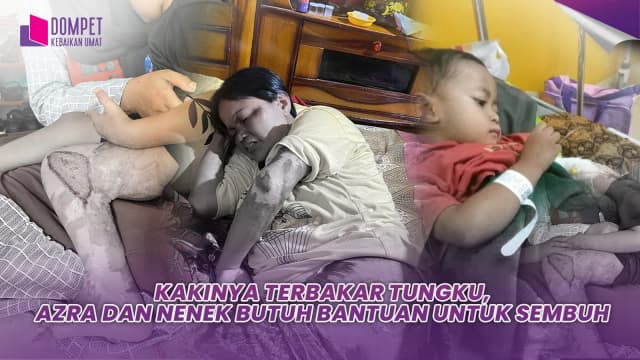 Tubuh Nenek Menimpa Tungku Api Kini Azra Tak Lagi Bisa Berjalan Normal