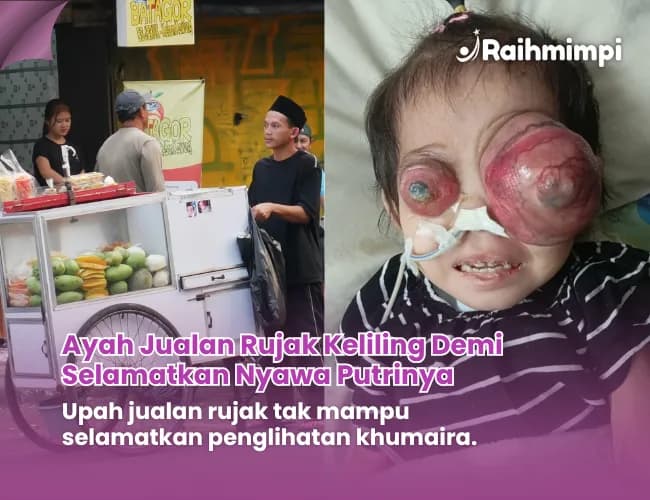 Foto campaign Luka Dibalik Gerobak Rujak Pak Latip Untuk Anak Sembuh