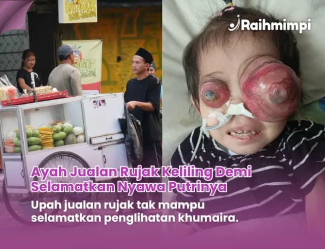 Luka Dibalik Gerobak Rujak Pak Latip Untuk Anak Sembuh