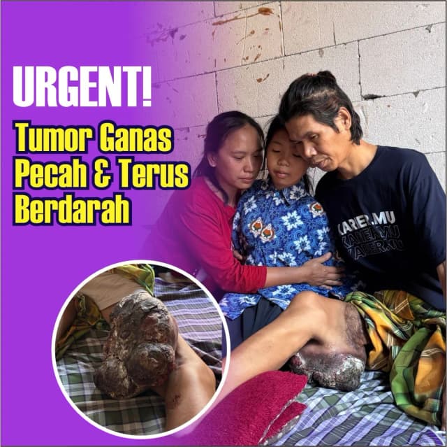 Tumor Ganas Pecah Pak Dadang Butuh Pertolongan Segera