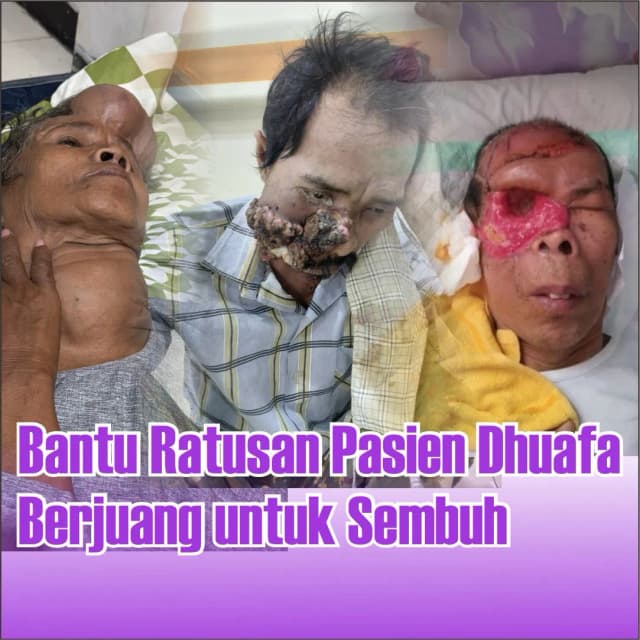 Patungan Bantu Pasien Dhuafa Melawan Penyakit Kronis