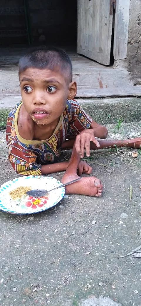 Bantu Dedy Yatim Difabel bisa dapat kehidupan layak