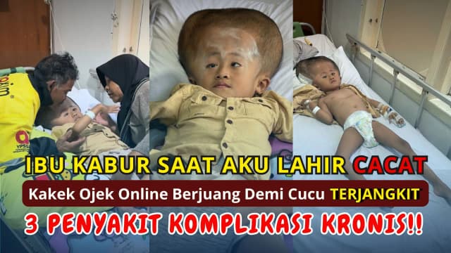 TOLONG Bantu Adik Tangguh Melawan 3 Penyakit Komplikasi Kronis