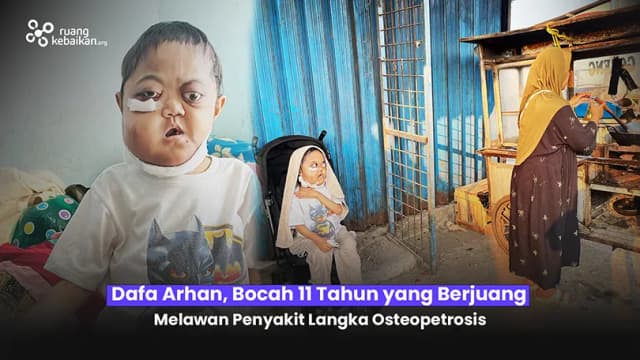 Usia 11 Tahun Dafa Harus Berjuang dengan Penyakit Langka