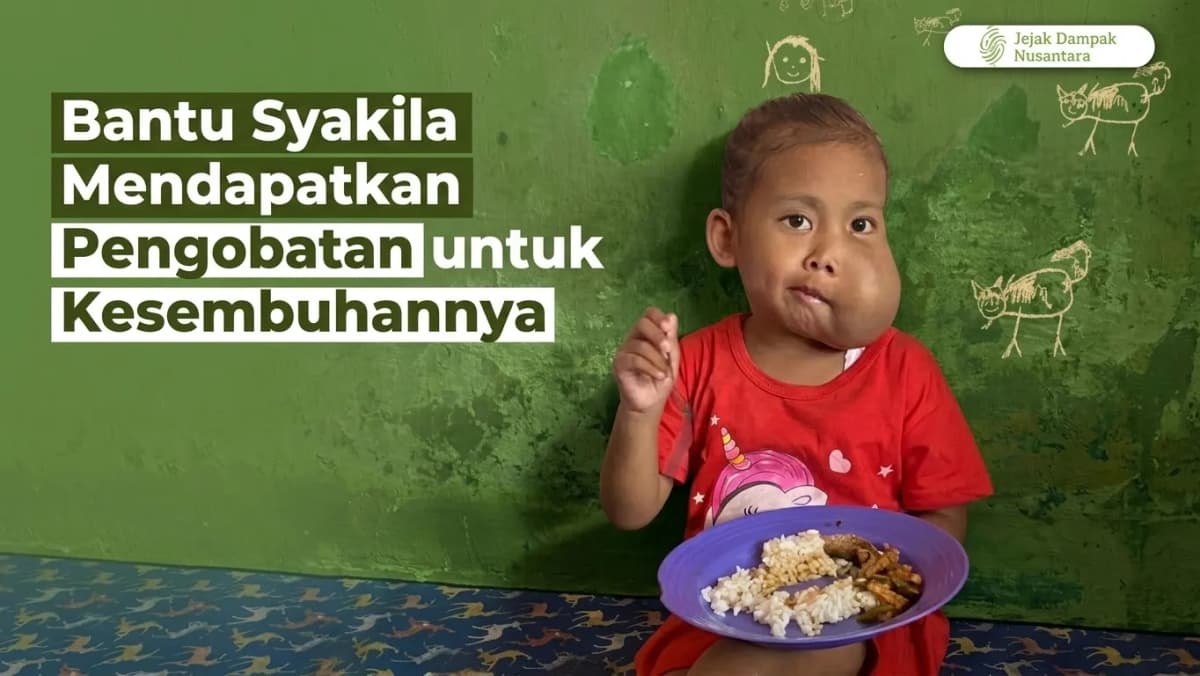 Foto campaign Bantu Syakila Mendapatkan Pengobatan untuk Kesembuhannya